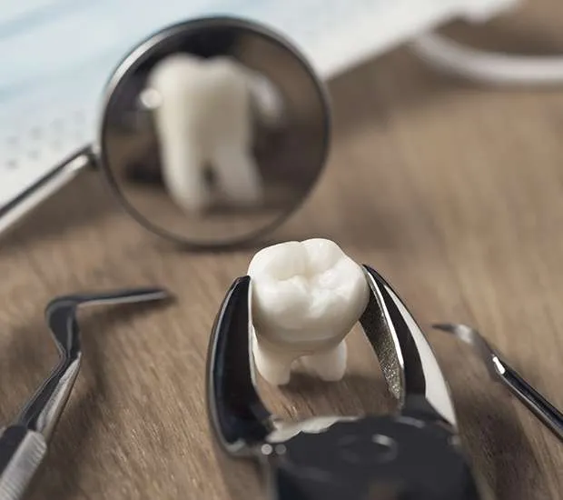 An extracted molar held in dental forceps on a tray beside a dental mirror.