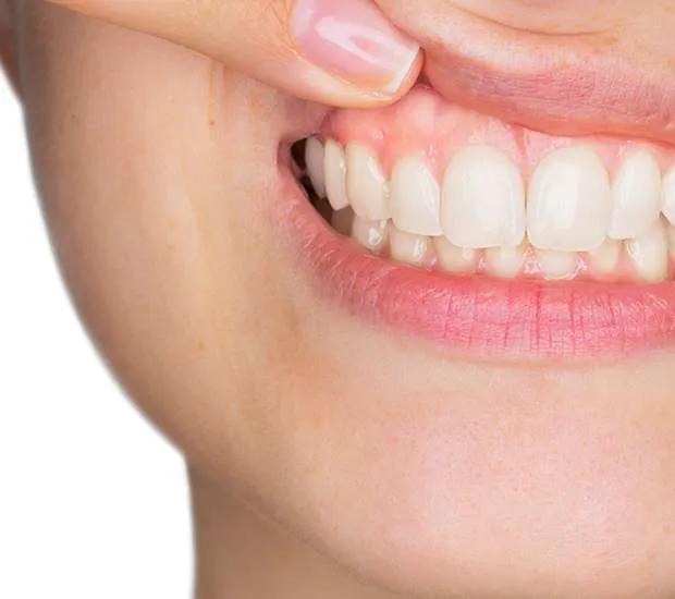 A close view of a smile with the upper lip lifted to show the gum line.