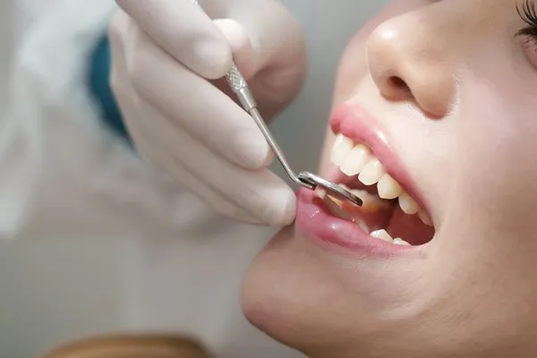 A gloved hand uses a dental scaler and mirror to clean a woman's teeth.