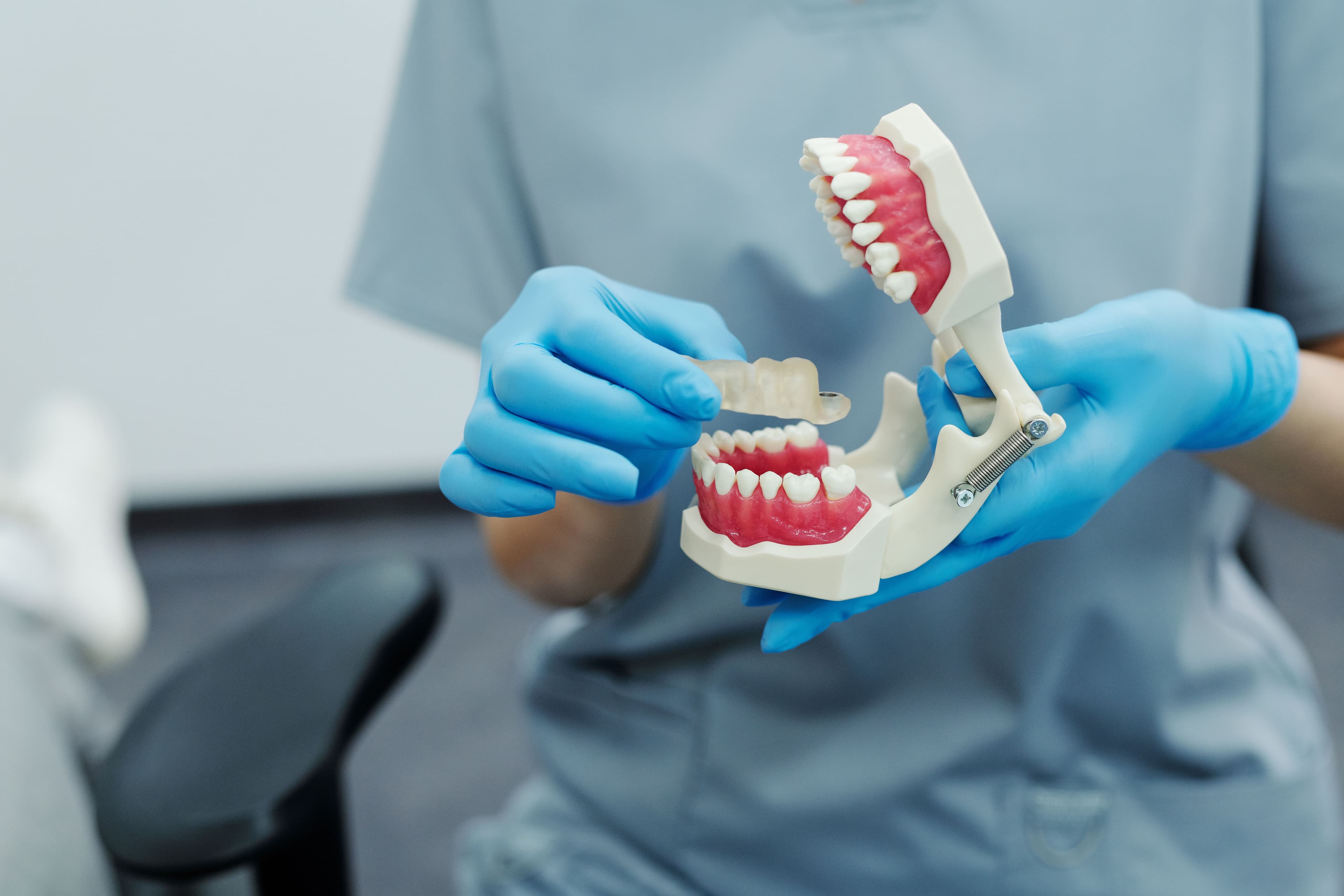 Gloved hands holding a model of the upper and lower teeth and jaw.