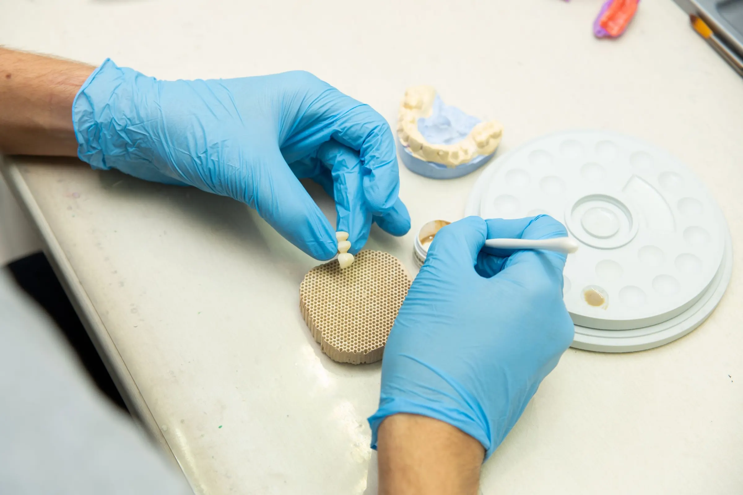 Blue-gloved hands holding a small three-unit porcelain bridge over a firing tray at a dental lab bench, a glazing brush in the other hand, with a plaster model and a mixing palette beside it.