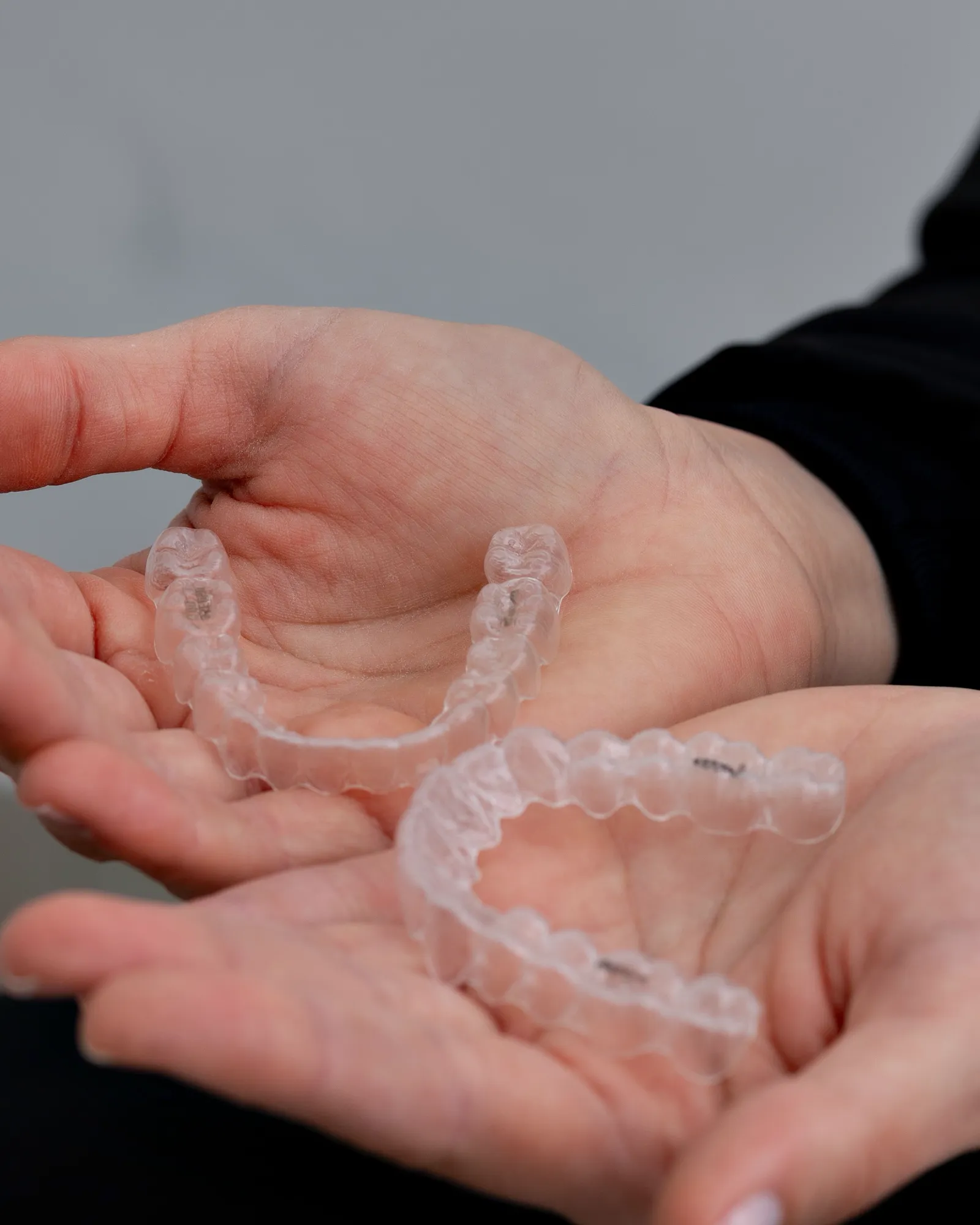 Two clear plastic dental guards resting in a person's open hands.