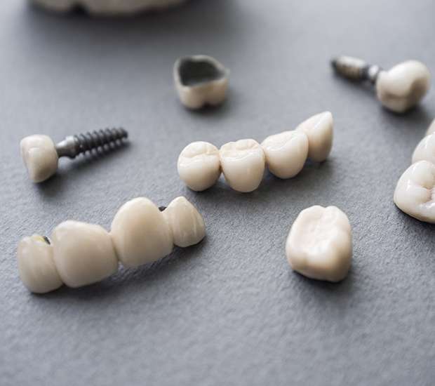 Winchester The Difference Between Dental Implants and Mini Dental Implants